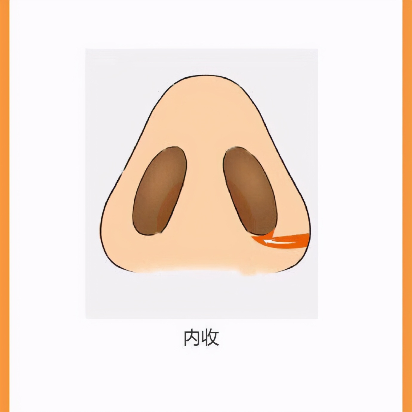 鼻翼缩小的办法(如何选择正确的缩鼻翼方式)-2 鼻翼缩小的办法(如何选择正确的缩鼻翼方式)